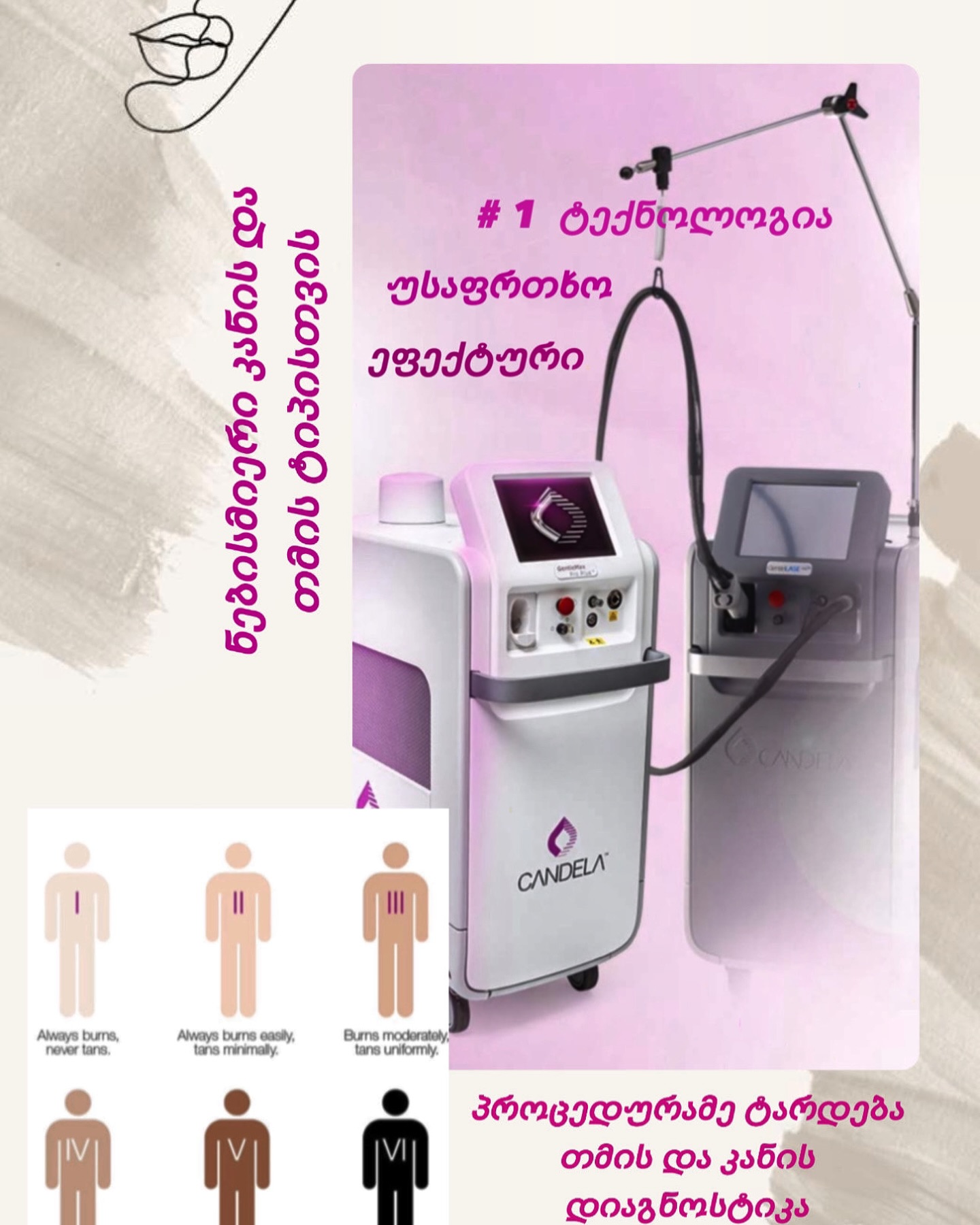 Candela laser technology at Express Laser